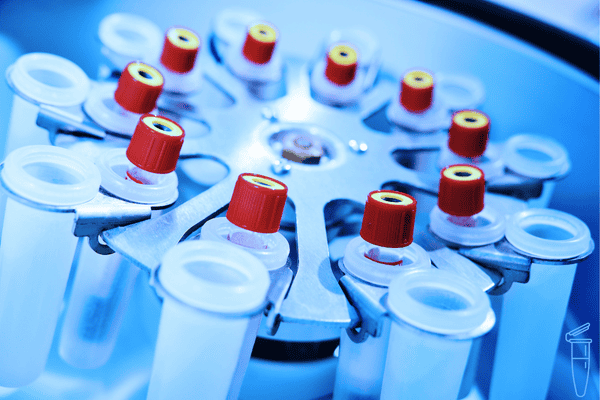 處理Hettich離心機(jī)蓋子無法打開的情況